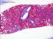 6 416 masson trichrome.jpg